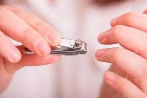 婆婆妈妈爆料灰指甲视频  第3张